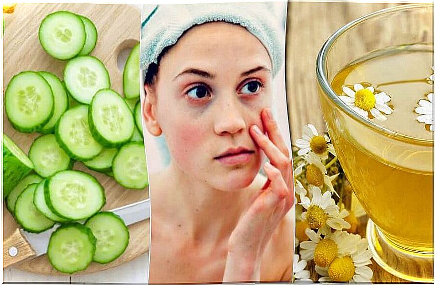 Bags and dark circles under the eyes - 5 natural ways