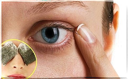 Home remedies for dark circles under the eyes