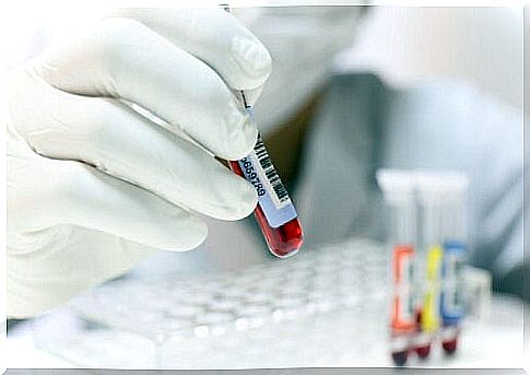 Blood test in the laboratory