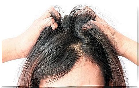 Itchy scalp - 5 natural ways to soothe