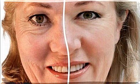 Woman - prunes face wrinkles