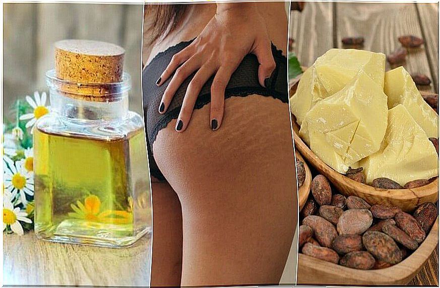 Stretch marks - reduce them with these home remedies